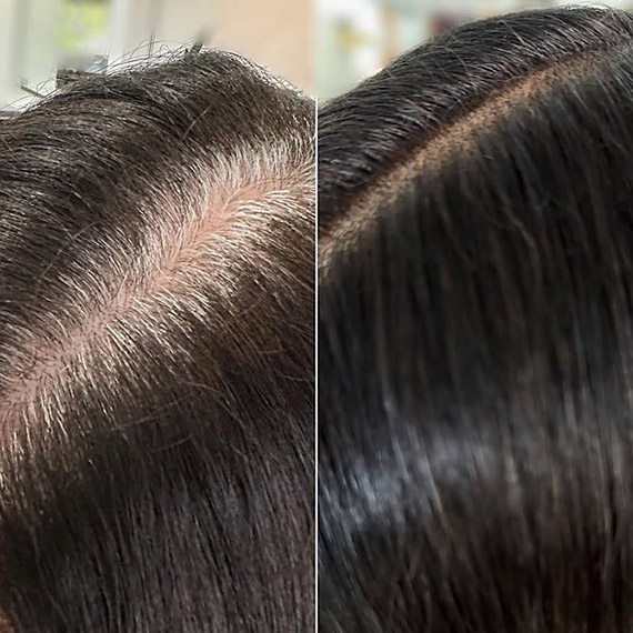 Before and after showing white roots on dark hair, covered by Koleston Xpress.